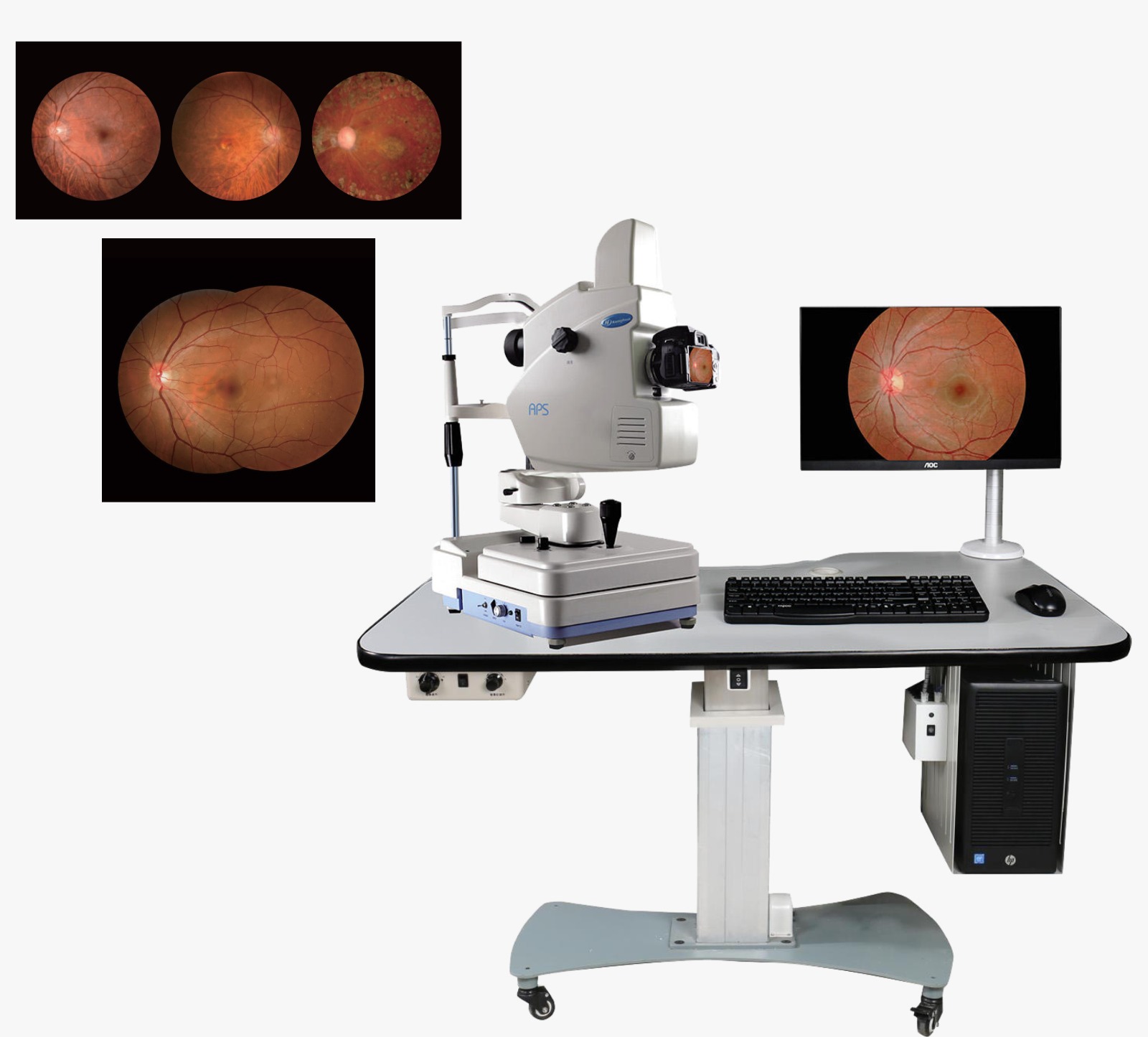 KANGHUAA APS-AER (MODEL A) FUNDUS CAMERA